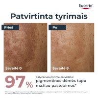 EUCERIN Anti-Pigment dvejopo poveikio veido serumas į hiperpigmentaciją linkusiai odai, 30 ml