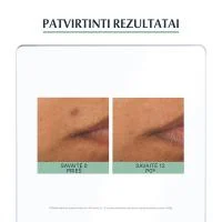 EUCERIN serumas aknės paliktų dėmių mažinimui DERMOPURE TRIPLE EFFECT 40 ml