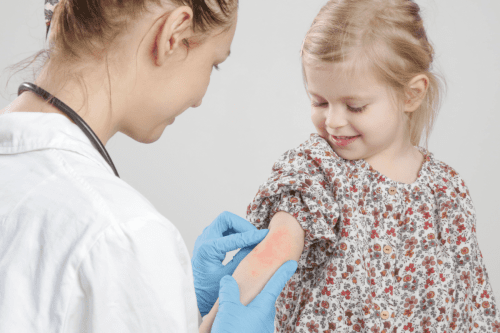 Dermatito ABC: kas tai, kaip atpažinti, kaip gydyti?