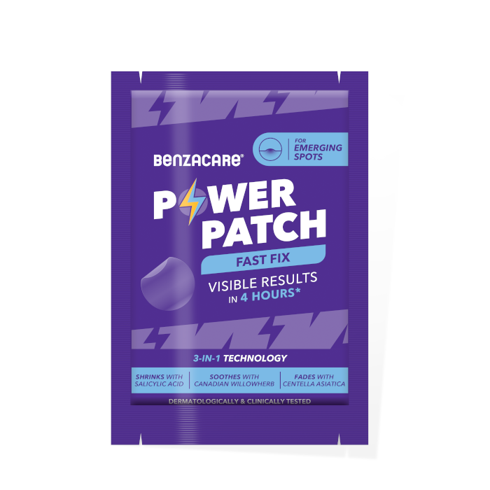 BENZACARE Power Patch Fast Fix pleistrai kylantiems spuogams, N36
