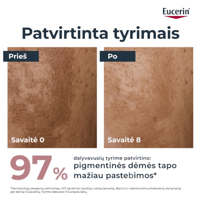 EUCERIN Anti-Pigment dieninis veido kremas SPF 30 į hiperpigmentaciją linkusiai odai, 50 ml