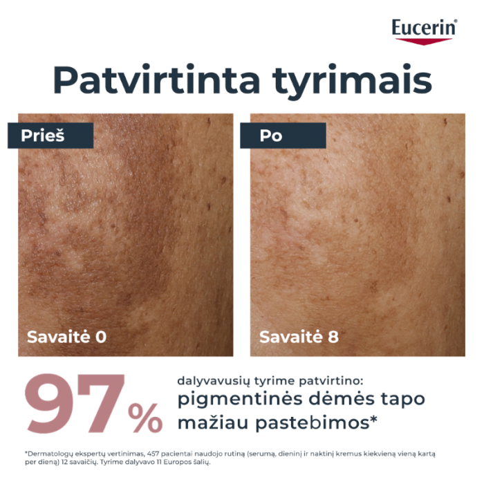 EUCERIN Anti-Pigment dvejopo poveikio veido serumas į hiperpigmentaciją linkusiai odai, 30 ml