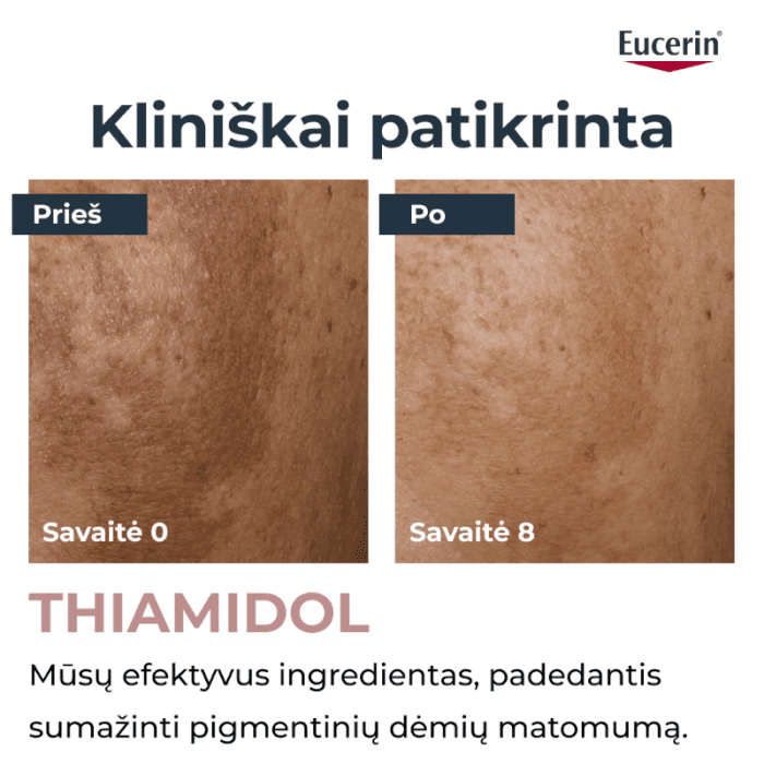 EUCERIN Anti-Pigment korektorius į pigmentaciją linkusiai odai, 5 ml